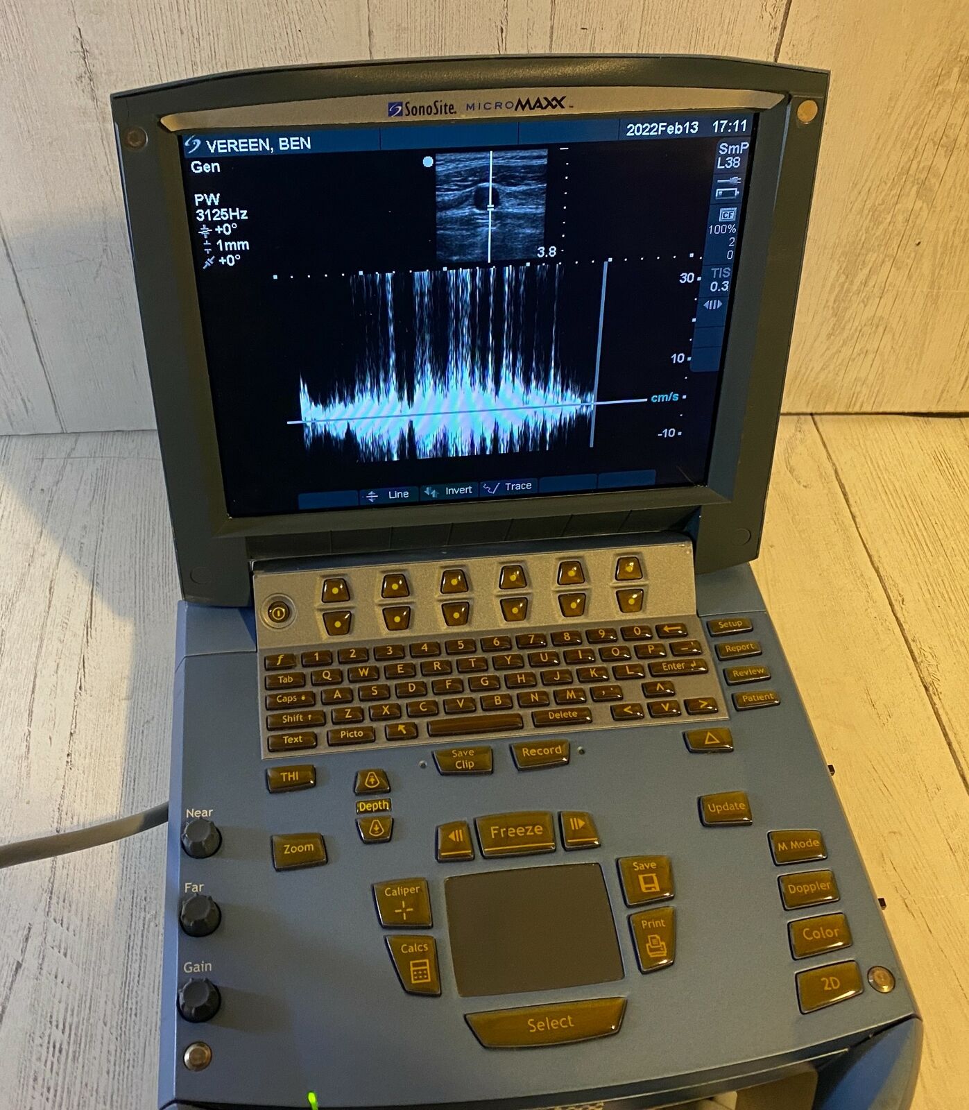 Sonosite MicroMaxx Portable Ultrasound 2008 - Main unit DIAGNOSTIC ULTRASOUND MACHINES FOR SALE