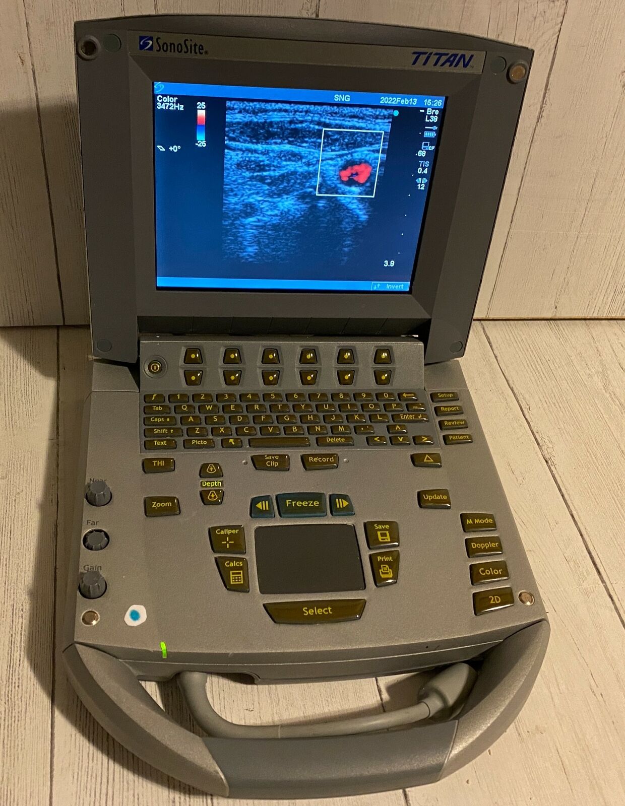 Sonosite Titan Portable Ultrasound 2005 - Main unit DIAGNOSTIC ULTRASOUND MACHINES FOR SALE