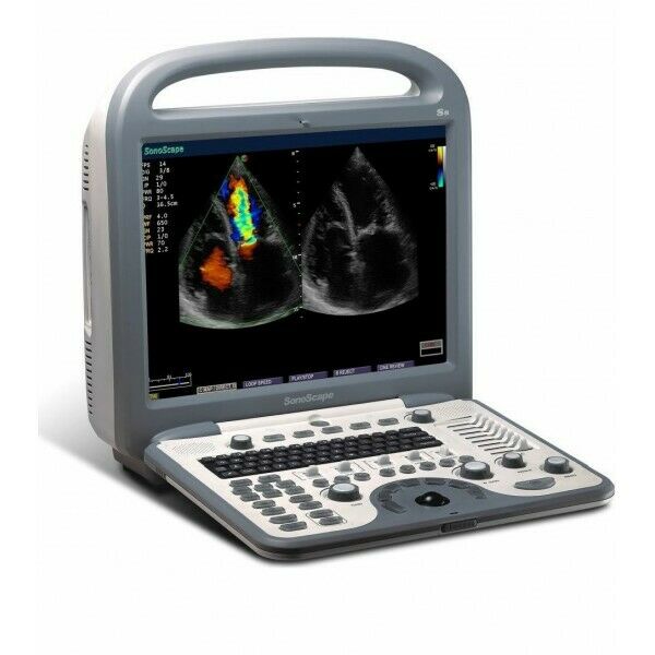 SonoScape S8 with L743 Linear array Probe Included - Used DIAGNOSTIC ULTRASOUND MACHINES FOR SALE