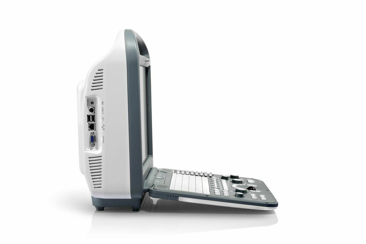 SonoScape S2 with Convex Abdominal Probe Included - Excellent Condition DIAGNOSTIC ULTRASOUND MACHINES FOR SALE