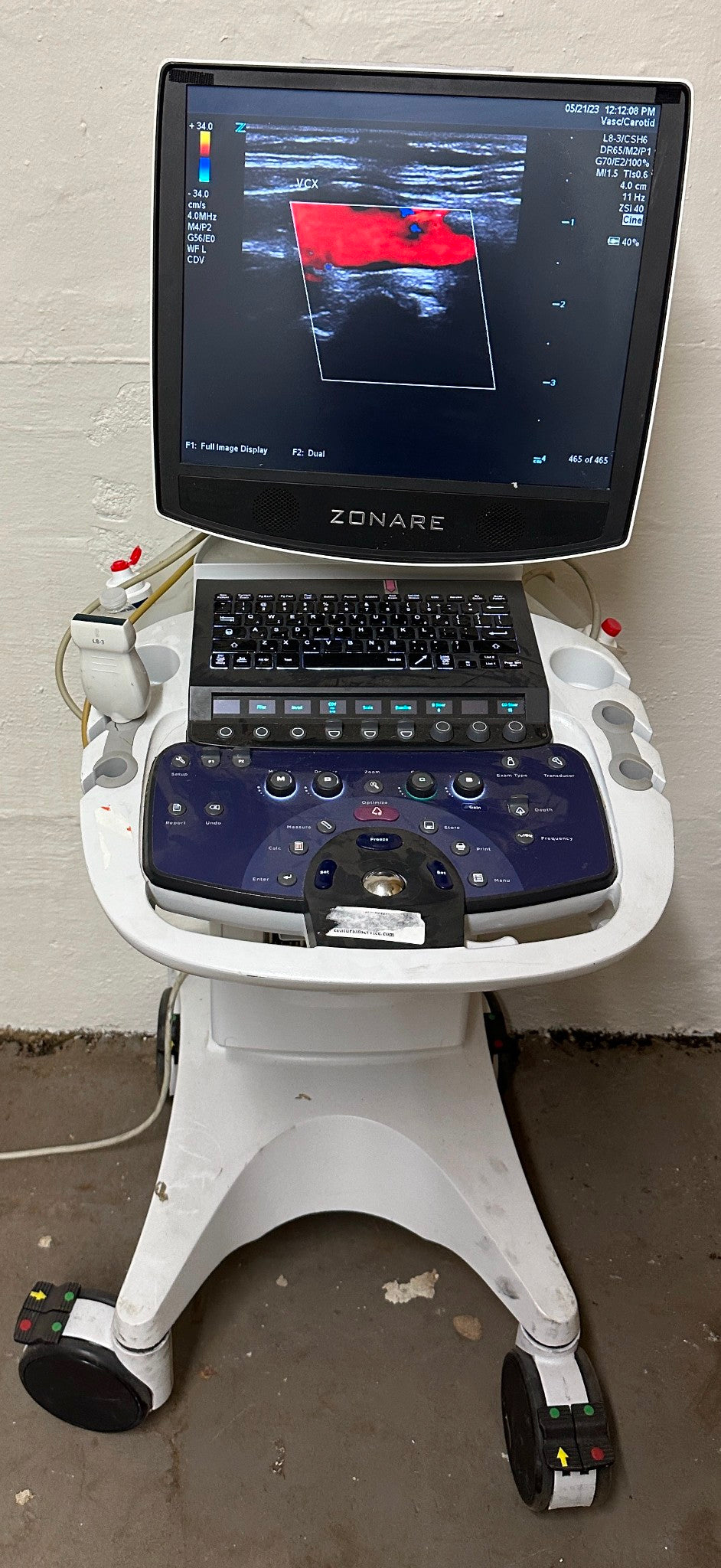 ZONARE ZS 3 Ultrasound Scanner Machine 2015 DIAGNOSTIC ULTRASOUND MACHINES FOR SALE