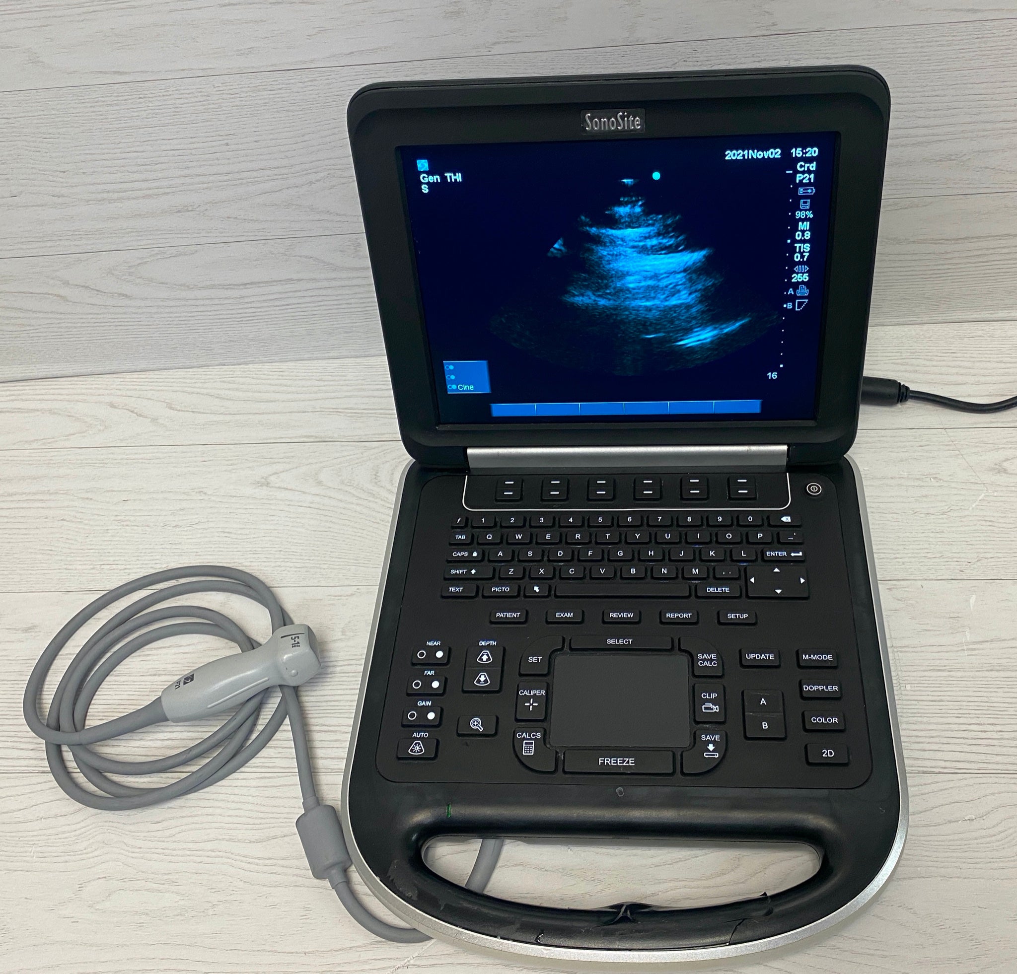 Sonosite Edge Portable ultrasound with P21 Cardiac probe 2012 DIAGNOSTIC ULTRASOUND MACHINES FOR SALE