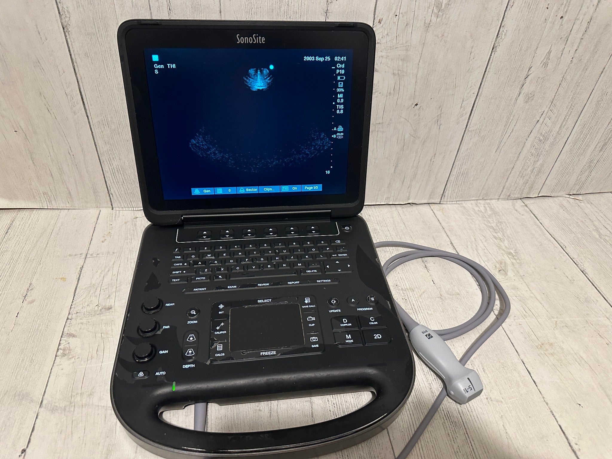 Sonosite Edge II Ultrasound 2016, DICOM with Phased Array probe rP19x DIAGNOSTIC ULTRASOUND MACHINES FOR SALE