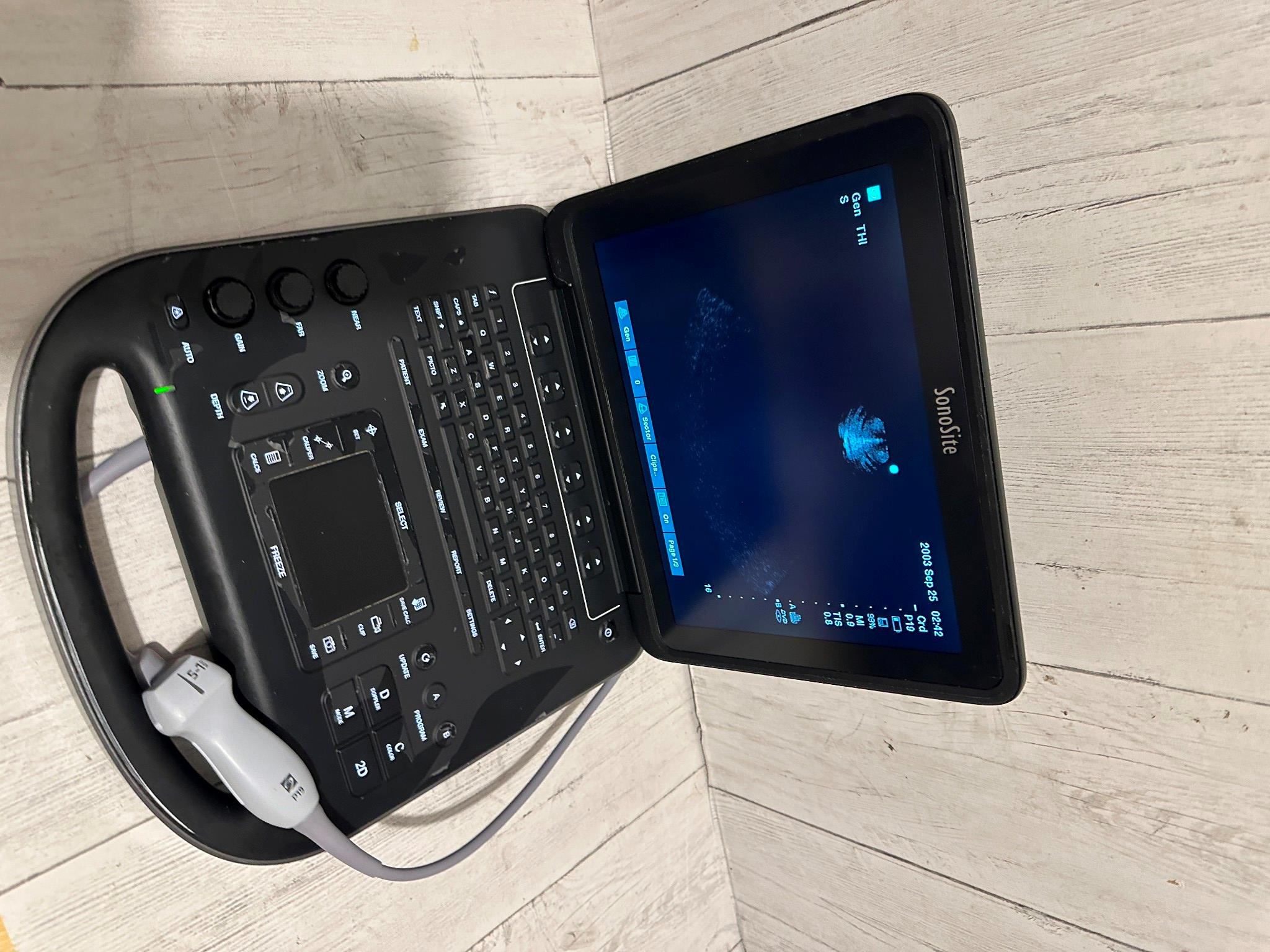 Sonosite Edge II Ultrasound 2016, DICOM with Phased Array probe rP19x DIAGNOSTIC ULTRASOUND MACHINES FOR SALE