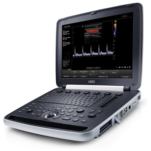 Samsung UGEO HM70A Portable Ultrasound DIAGNOSTIC ULTRASOUND MACHINES FOR SALE