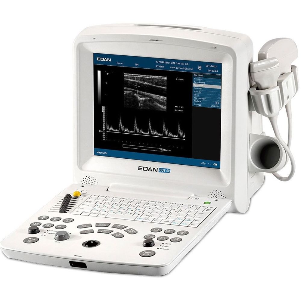 Edan DUS 60 Digital Ultrasonic Diagnostic Imaging System DIAGNOSTIC ULTRASOUND MACHINES FOR SALE