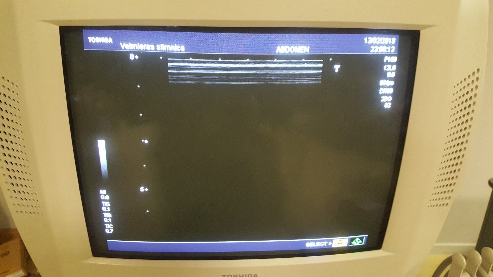 Toshiba Nemio 35 SSA-550A Diagnostic Ultrasound System DIAGNOSTIC ULTRASOUND MACHINES FOR SALE