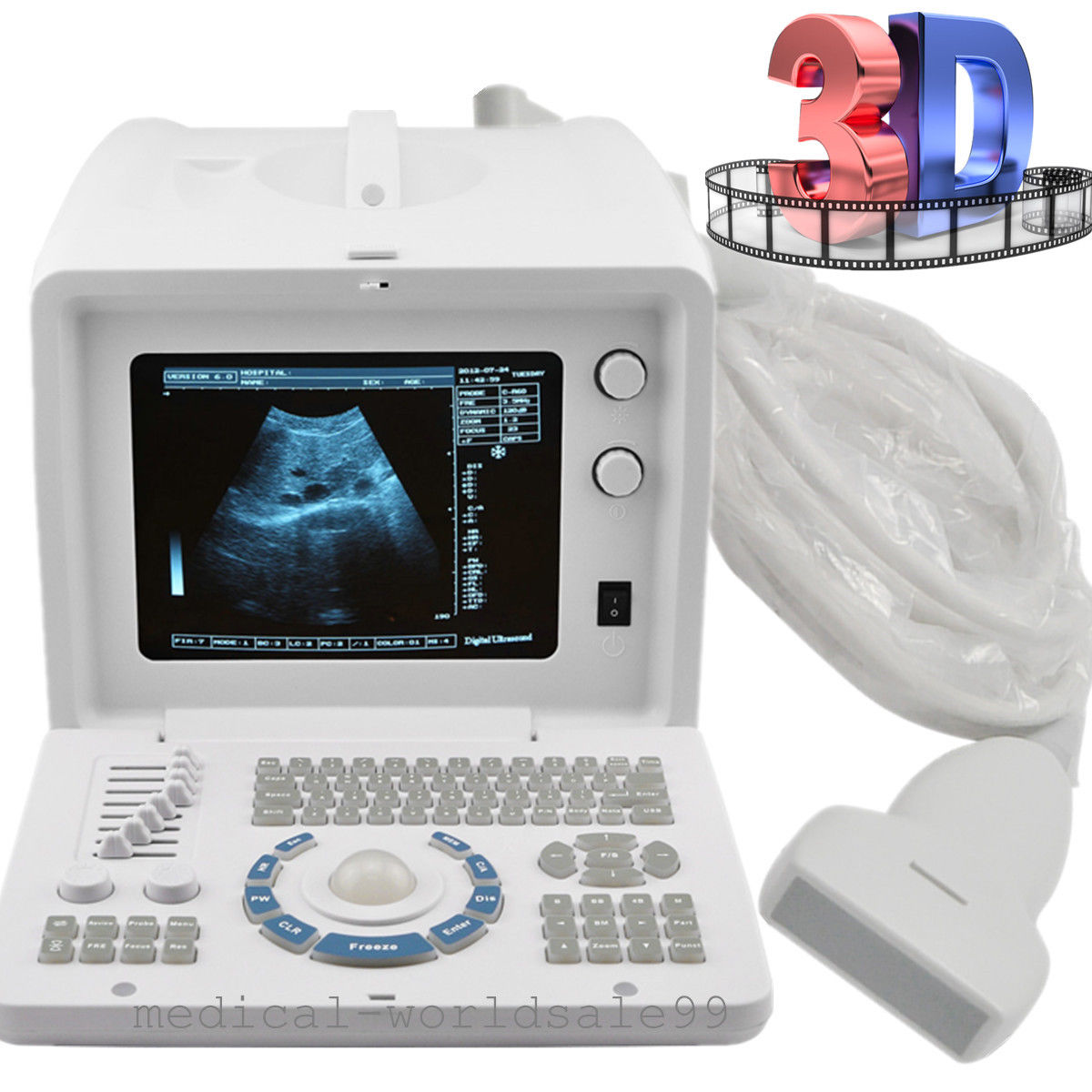 Ultrasonic Ultrasound Scanner Ultrasound Scanning+7.5Mhz Linear Array probe CE DIAGNOSTIC ULTRASOUND MACHINES FOR SALE