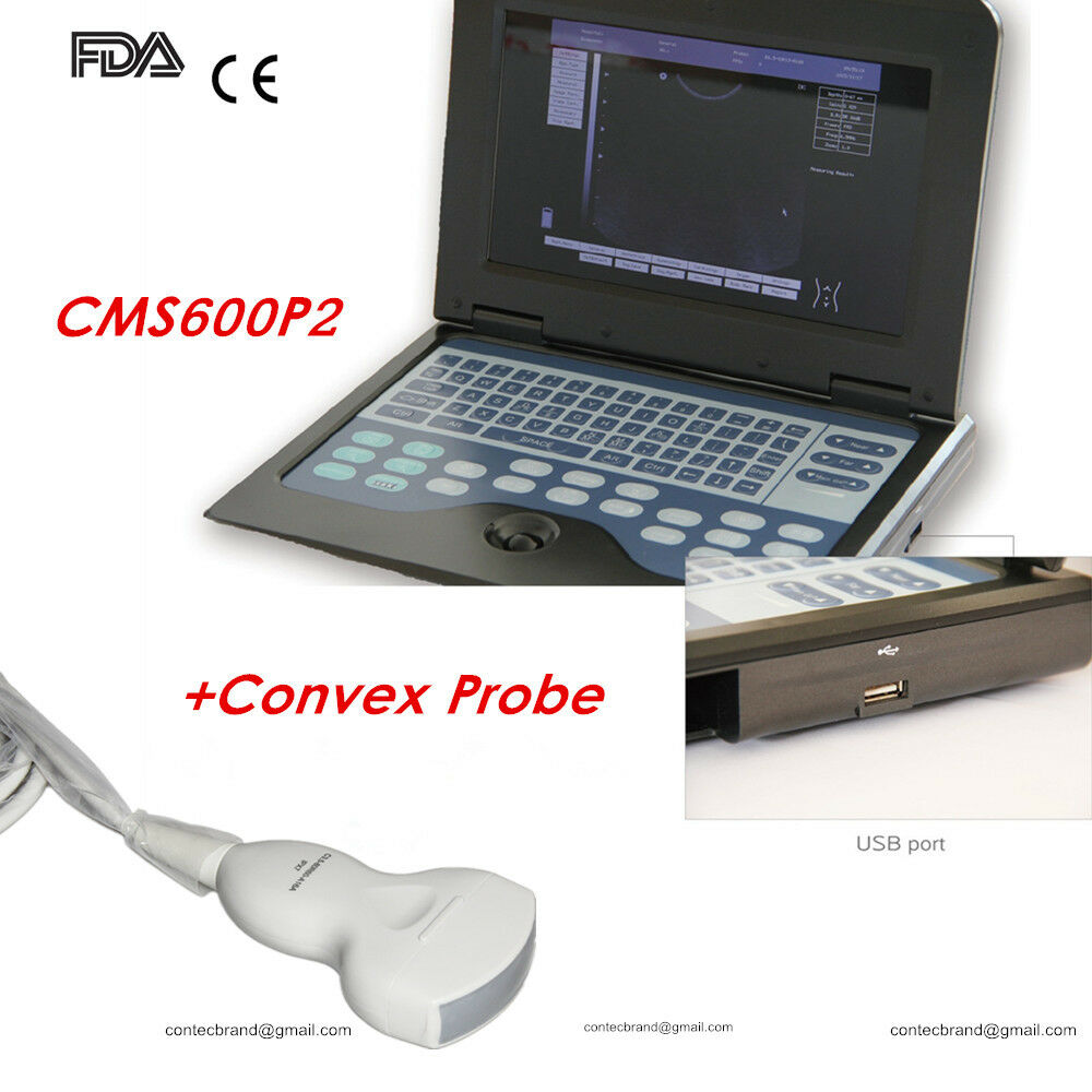 New Portable Digital Medical Ultrasound Scanner Machine Convex Probe, US Seller 6945040100362 DIAGNOSTIC ULTRASOUND MACHINES FOR SALE