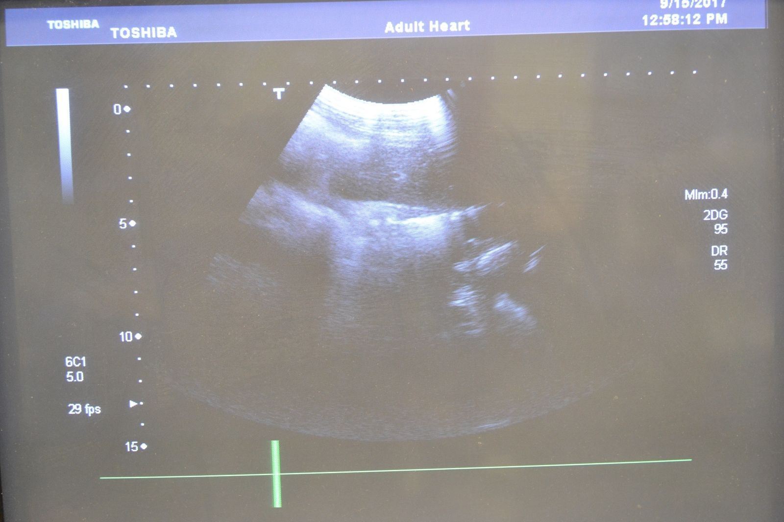 Toshiba Aplio 500 PVT-375BT 6-1.9MHz Convex Abdominal Transducer Probe DIAGNOSTIC ULTRASOUND MACHINES FOR SALE