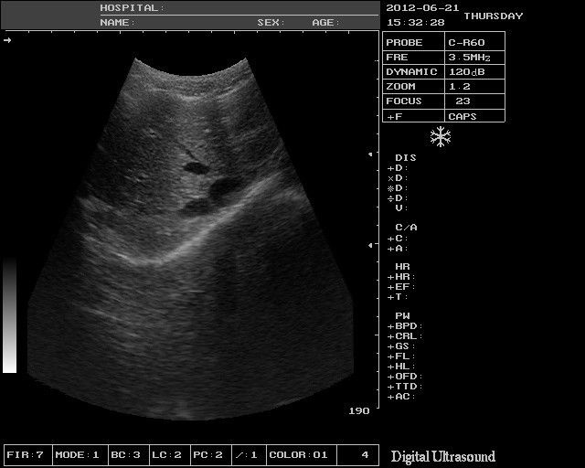 Profession Digital Ultrasound Scanner Convex Probe 3D software Optional Linear 190891927064 DIAGNOSTIC ULTRASOUND MACHINES FOR SALE