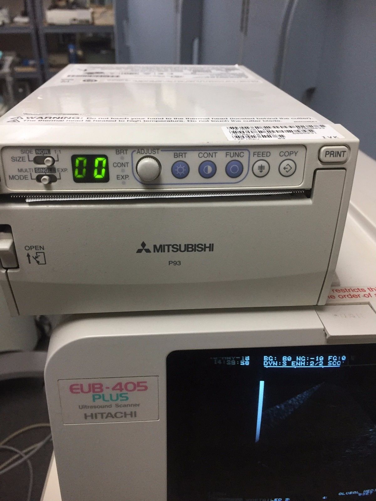 Hitachi EUB-405 Plus Ultrasound / 2 probes / 2 transducer port / printer DIAGNOSTIC ULTRASOUND MACHINES FOR SALE