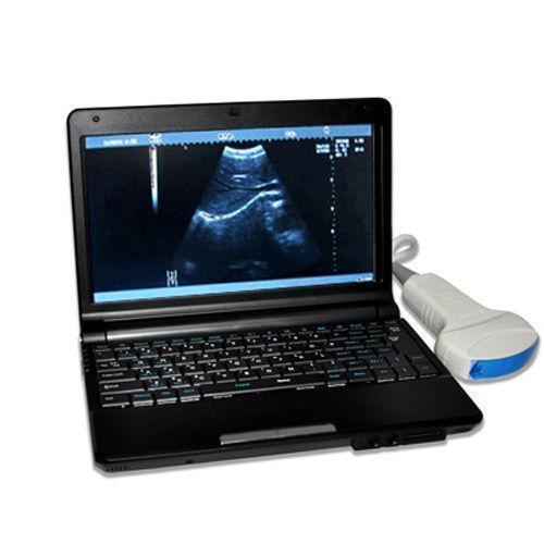 FULL Digital Laptop Ultrasound Scanner+Linear & Transvaginal 2 probe 3D Sale CE DIAGNOSTIC ULTRASOUND MACHINES FOR SALE