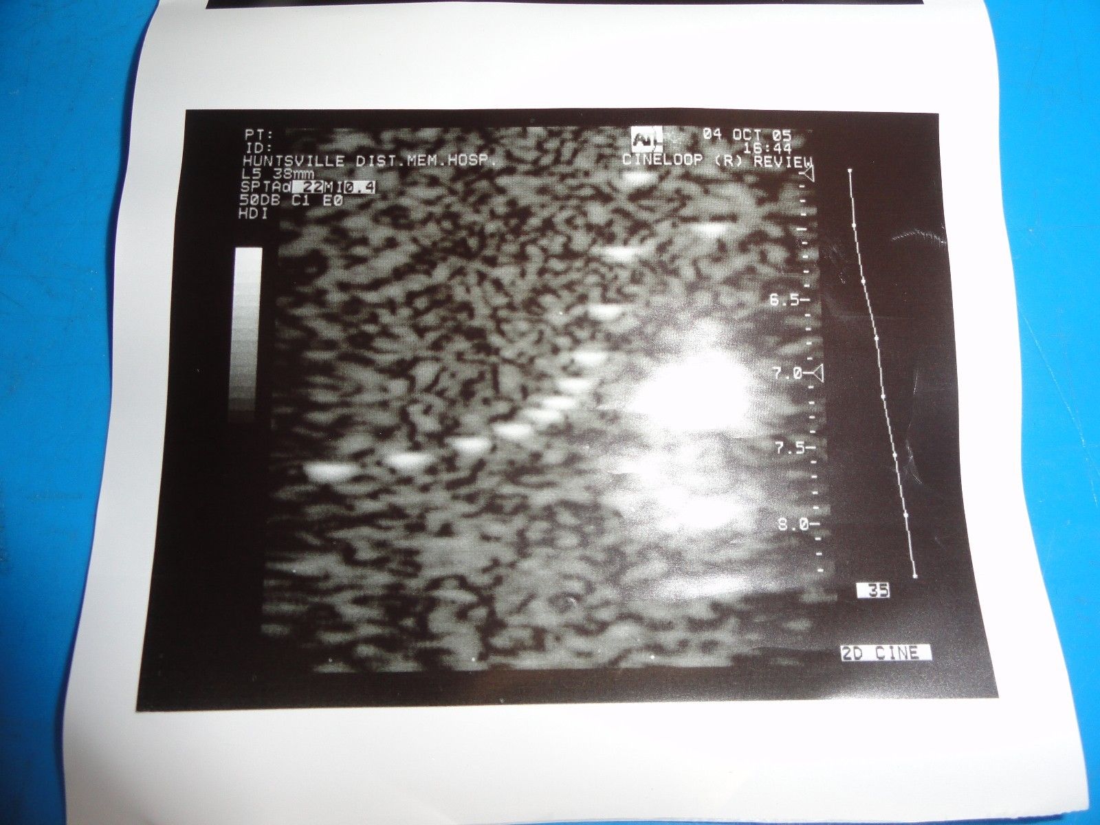 ATL L5 38MM (5.0LA) P/N 4000-0259-02D Linear Array Probe for UM9 HDI (8927) DIAGNOSTIC ULTRASOUND MACHINES FOR SALE