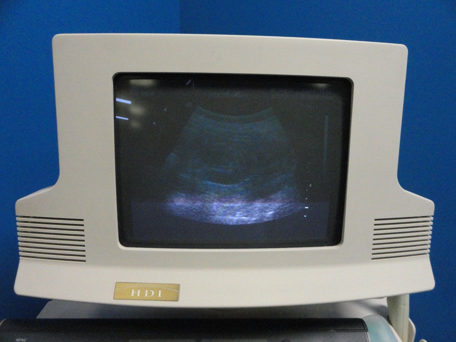 Philips ATL C3.5 76R Convex / Curved Array Ultrasound Transducer Probe (8837) DIAGNOSTIC ULTRASOUND MACHINES FOR SALE