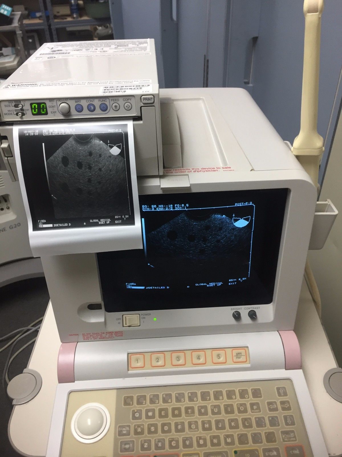 Hitachi EUB-405 Plus Ultrasound / 2 probes / 2 transducer port / printer DIAGNOSTIC ULTRASOUND MACHINES FOR SALE