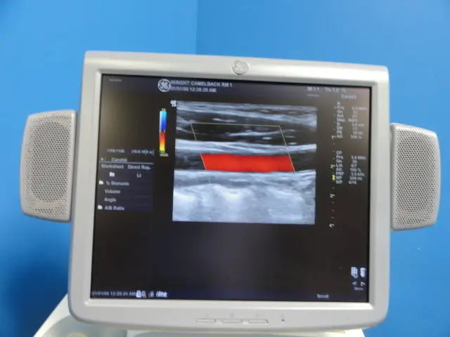 GE 7L Linear Array Ultrasound Transducer for Logiq & Vivid Series (10760) DIAGNOSTIC ULTRASOUND MACHINES FOR SALE