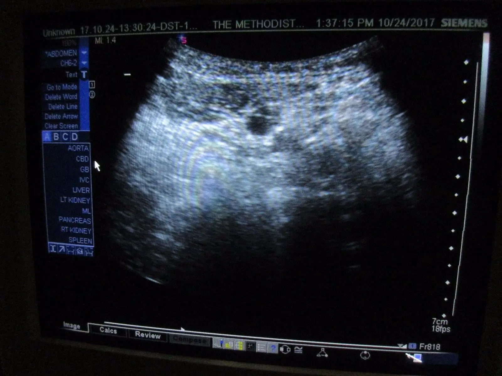 Siemens Sonoline Antares ver 3.5 Ultrasound TESTED by Certified Ultrasound Tech DIAGNOSTIC ULTRASOUND MACHINES FOR SALE