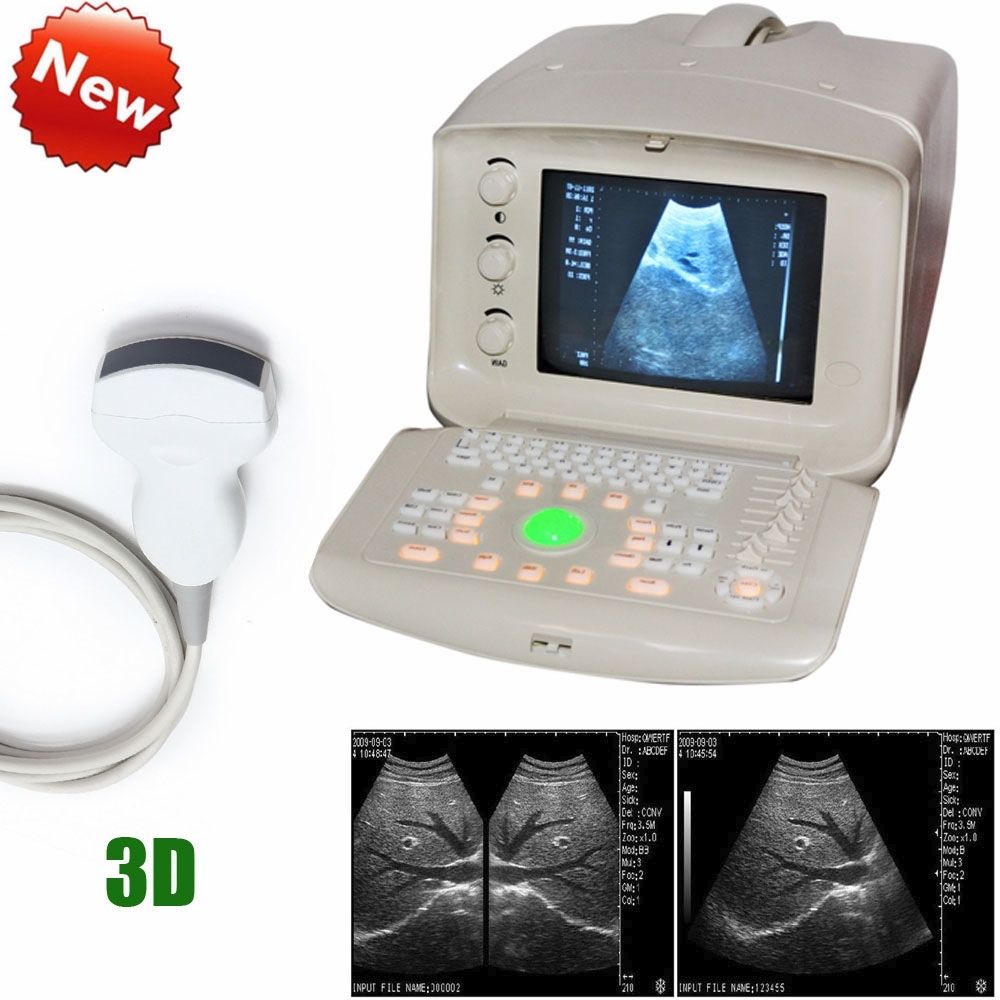 Digital Ultrasound Scanner/Machine 3.5Mhz Convex Transducer/Probe 3D A+ DIAGNOSTIC ULTRASOUND MACHINES FOR SALE
