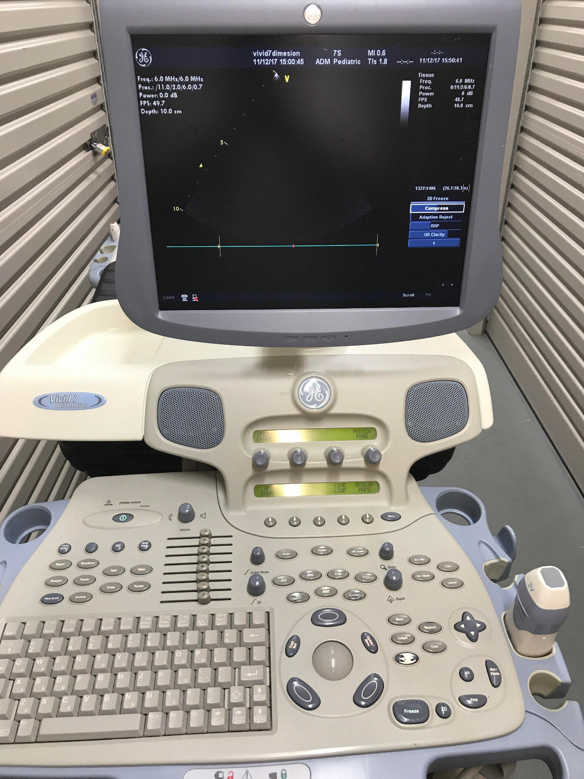GE VIVID 7 ULTRASOUND CARDIAC 2010 / MANY OPTIONS / 2 X PROBES / 4D 3V & M4S DIAGNOSTIC ULTRASOUND MACHINES FOR SALE