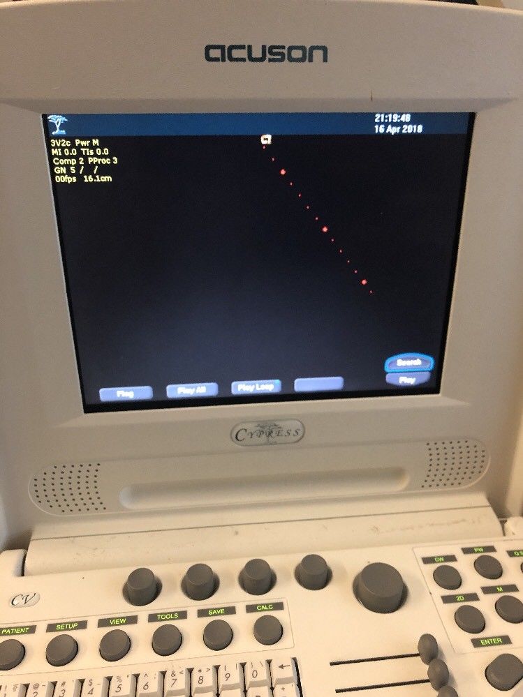 SIEMENS Acuson Cypress Ultrasound Machine with 3V2c probe DIAGNOSTIC ULTRASOUND MACHINES FOR SALE