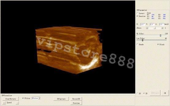 Digital Ultrasound Scanner Machine +Convex +Vaginal + Linear 3 Probes/Sensor+3D DIAGNOSTIC ULTRASOUND MACHINES FOR SALE