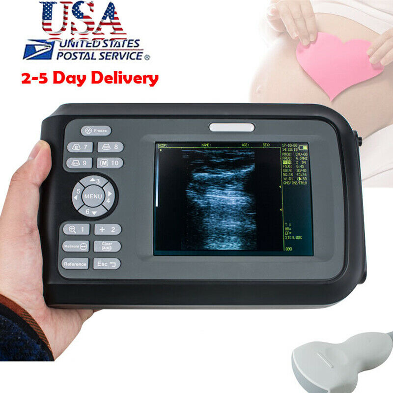Handscan Ultrasound Scanner Machine Digital For Human Use 3.5Mhz Convex Probe US DIAGNOSTIC ULTRASOUND MACHINES FOR SALE
