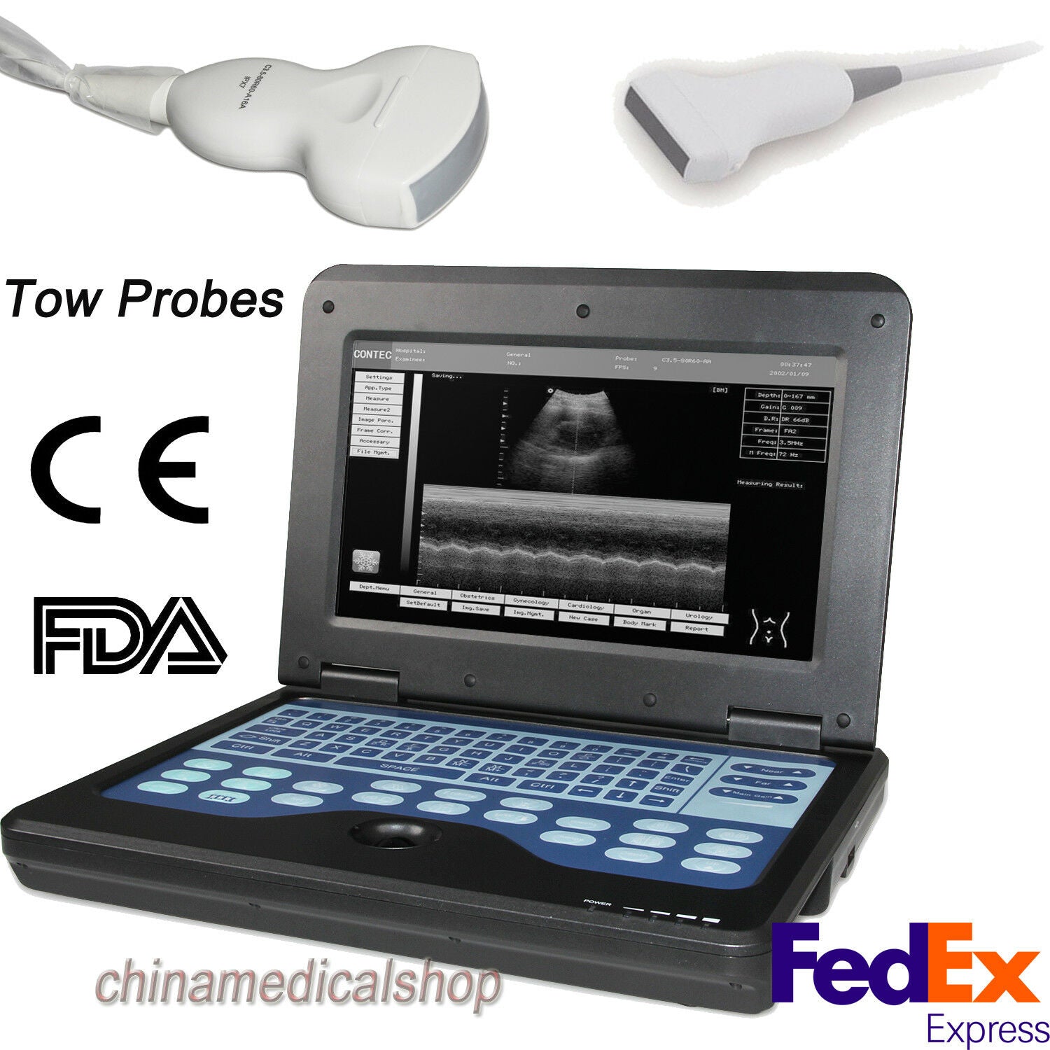 Portable Ultrasound scanner Laptop machine tow probes 3.5M convex 7.5M linear US DIAGNOSTIC ULTRASOUND MACHINES FOR SALE