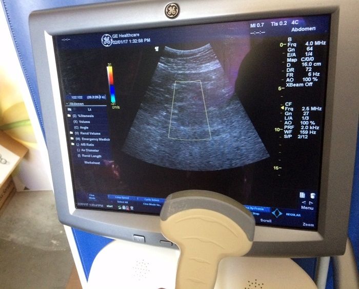 GE Logiq P3 Expert Ultrasound System R1.0.5 DIAGNOSTIC ULTRASOUND MACHINES FOR SALE