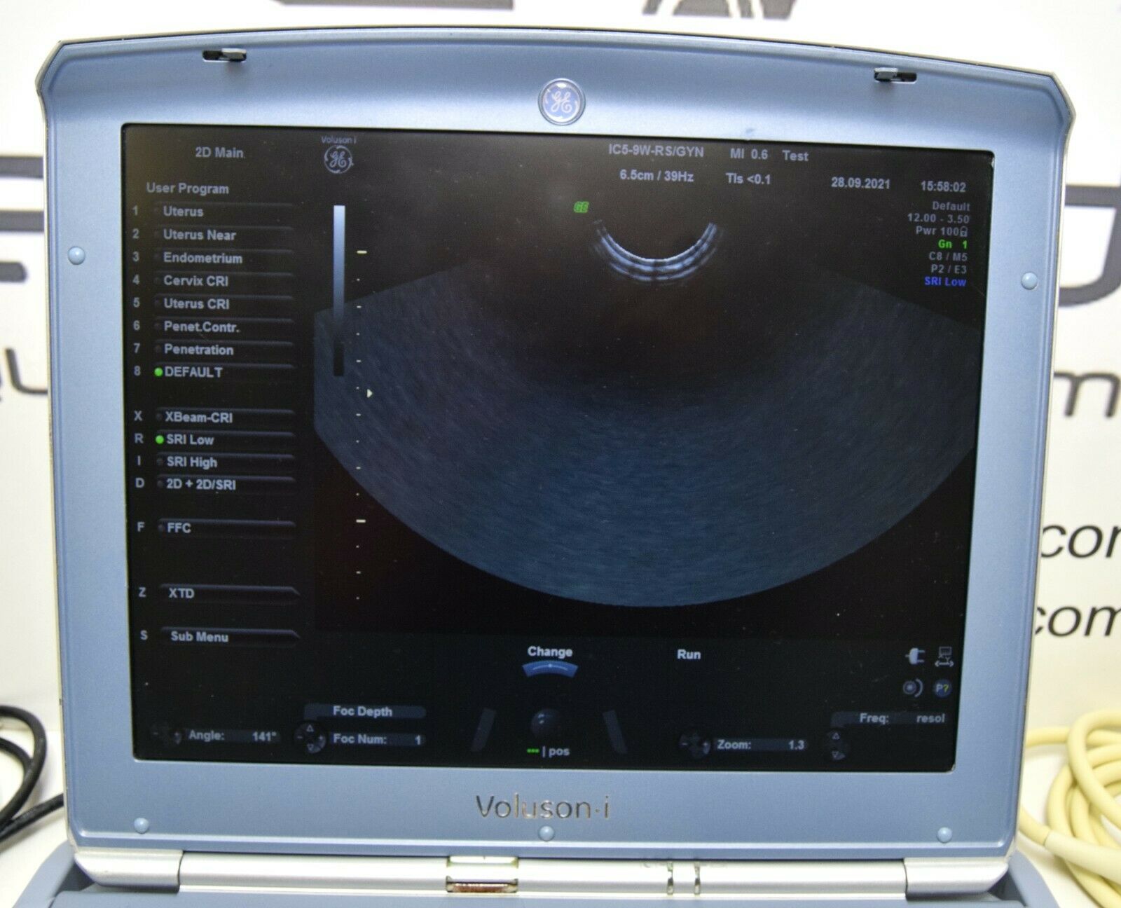 GE Voluson I BT14 portable ultrasound with 3 probes (year of manufacture 2016) DIAGNOSTIC ULTRASOUND MACHINES FOR SALE