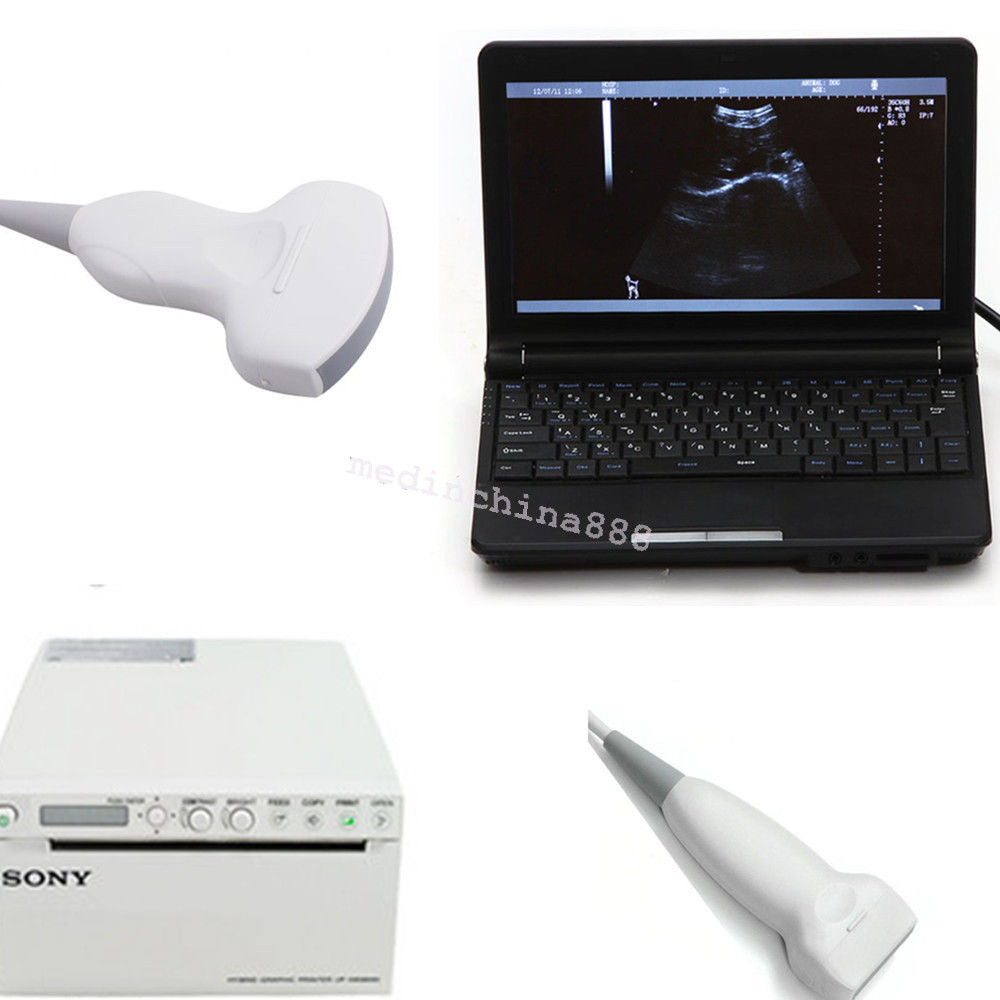 Digital LCD Ultrasound Scanner Machine+Convex + Linear Probe+Sony Printer 190891246417 DIAGNOSTIC ULTRASOUND MACHINES FOR SALE