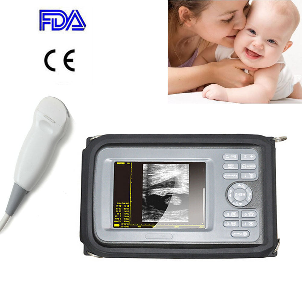 5.5 " Handheld Ultrasound Scanner/Machine Digital Micro-convex Probe Human CE DIAGNOSTIC ULTRASOUND MACHINES FOR SALE