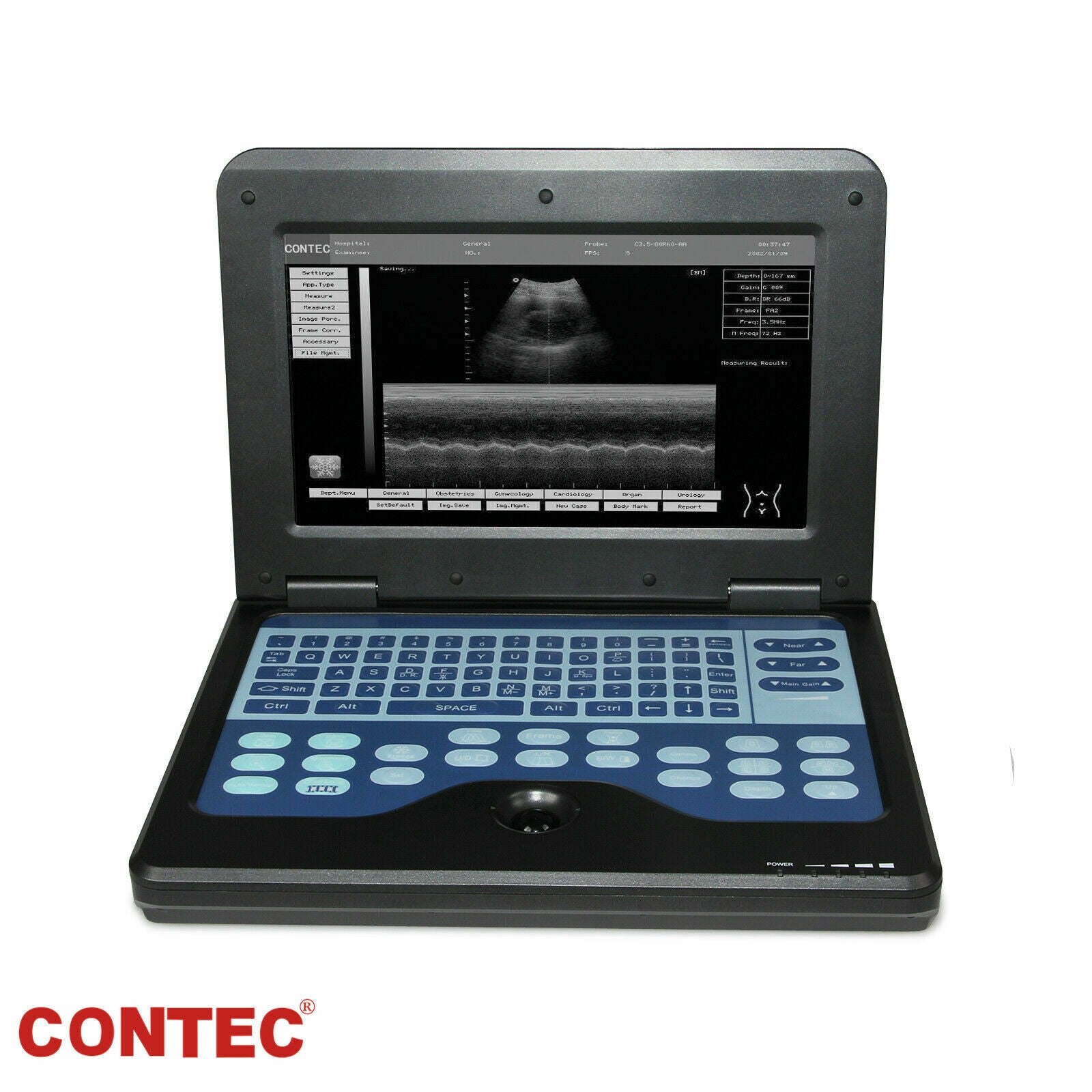 Digital Portable Ultrasound Machine Laptop Scanner with 3.5Mhz Convex Probe CE 6945040100362 DIAGNOSTIC ULTRASOUND MACHINES FOR SALE