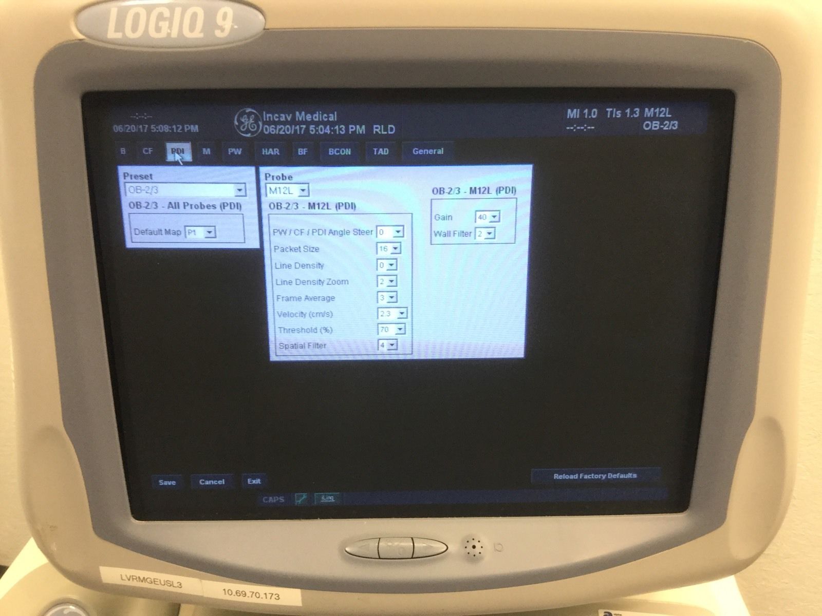 GE Logiq 9 Ultrasound 2003 BT03 + 8L + M12L + 3.5C DIAGNOSTIC ULTRASOUND MACHINES FOR SALE