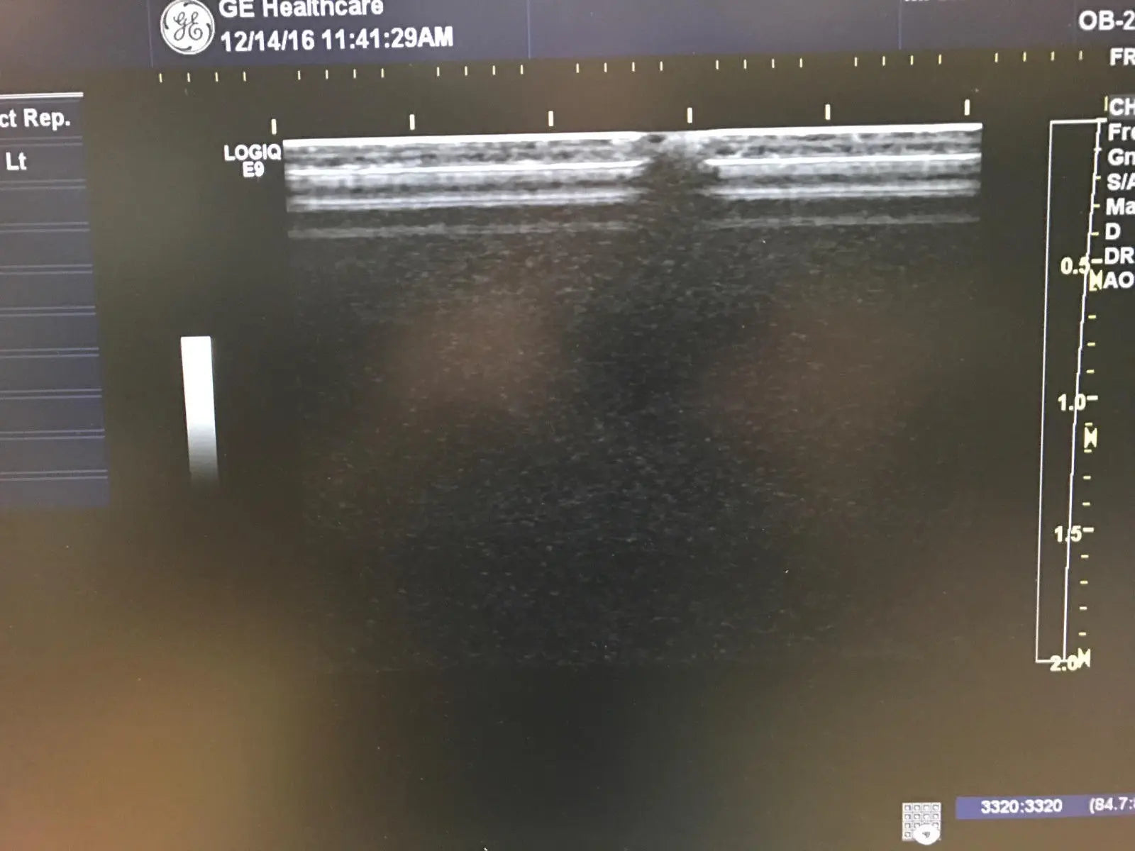 GE L8-18i-D Ultrasound Probe Transducer DIAGNOSTIC ULTRASOUND MACHINES FOR SALE