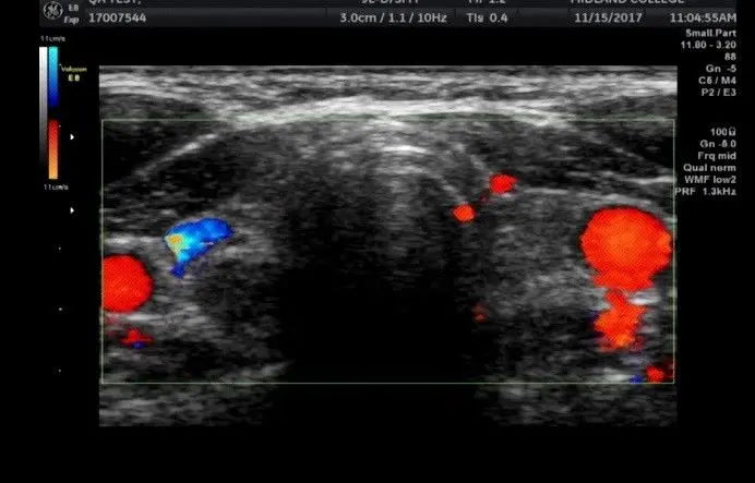 GE Voluson E8 BT13 with HDLive Ultrasound System DIAGNOSTIC ULTRASOUND MACHINES FOR SALE