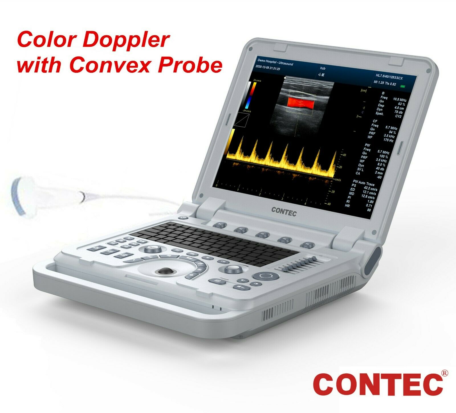Portable Ultrasound Scanner Color Doppler Muscle Blood Vessel CW Optional 3D/ 4D DIAGNOSTIC ULTRASOUND MACHINES FOR SALE