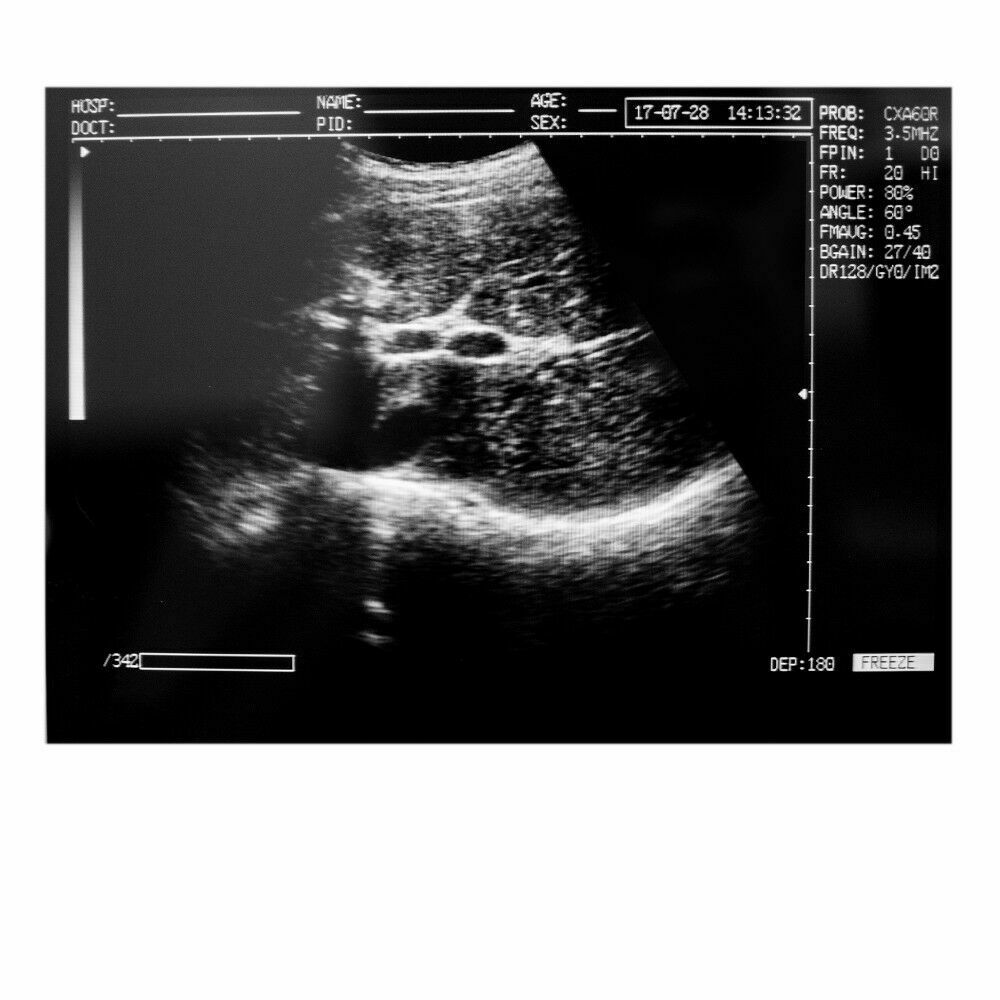 New Portable Notebook Digital Laptop Machine Ultrasound Scanner Convex Probe+3D DIAGNOSTIC ULTRASOUND MACHINES FOR SALE