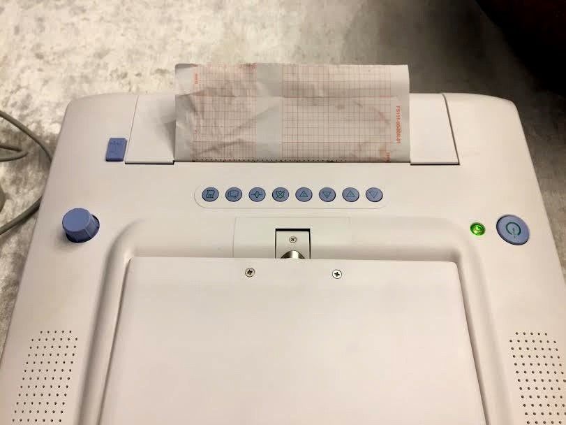 EDAN MD Pro MP-30 Twins Fetal Monitor DIAGNOSTIC ULTRASOUND MACHINES FOR SALE