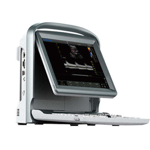 Color Doppler Chison Ultrasound & Linear Probe, Trolley, Battery, PW Vascular DIAGNOSTIC ULTRASOUND MACHINES FOR SALE