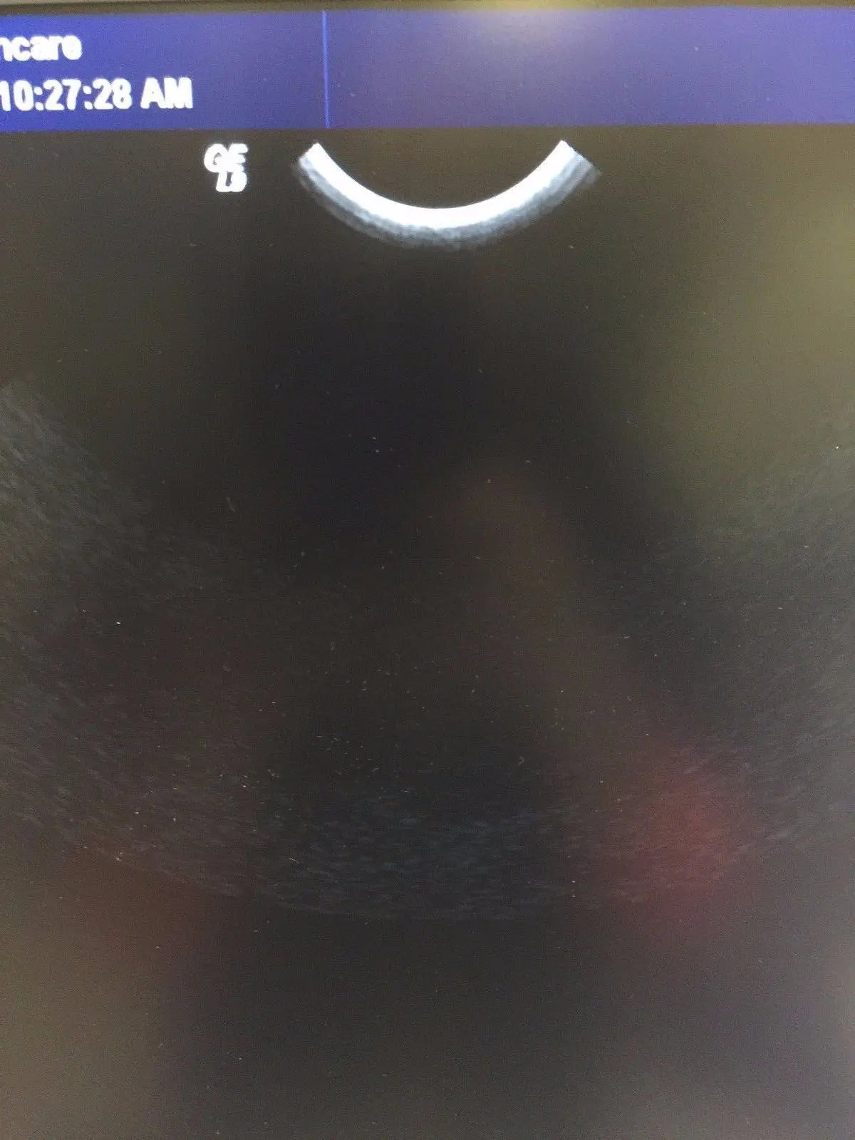 GE E8C Endocavity Ultrasound Transducer for GE Logiq Systems DIAGNOSTIC ULTRASOUND MACHINES FOR SALE