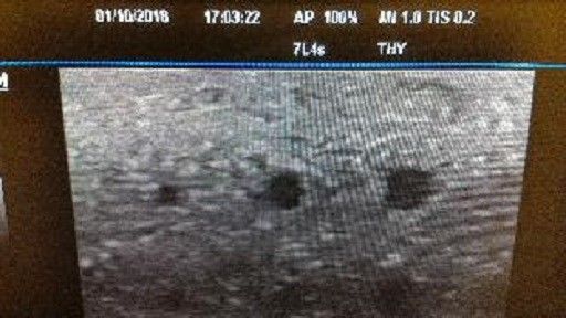 Mindray M5 Ultrasound w/cart DIAGNOSTIC ULTRASOUND MACHINES FOR SALE