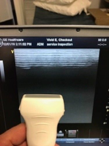 GE Vivid E Cardiac/Vascular/General Portable Ultrasound with 4 probes DIAGNOSTIC ULTRASOUND MACHINES FOR SALE