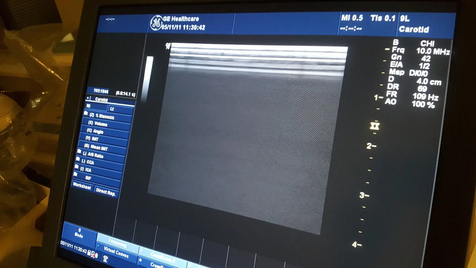 GE Logiq P6 Diagnostic Ultrasound unit OB/GYN/Abd DIAGNOSTIC ULTRASOUND MACHINES FOR SALE