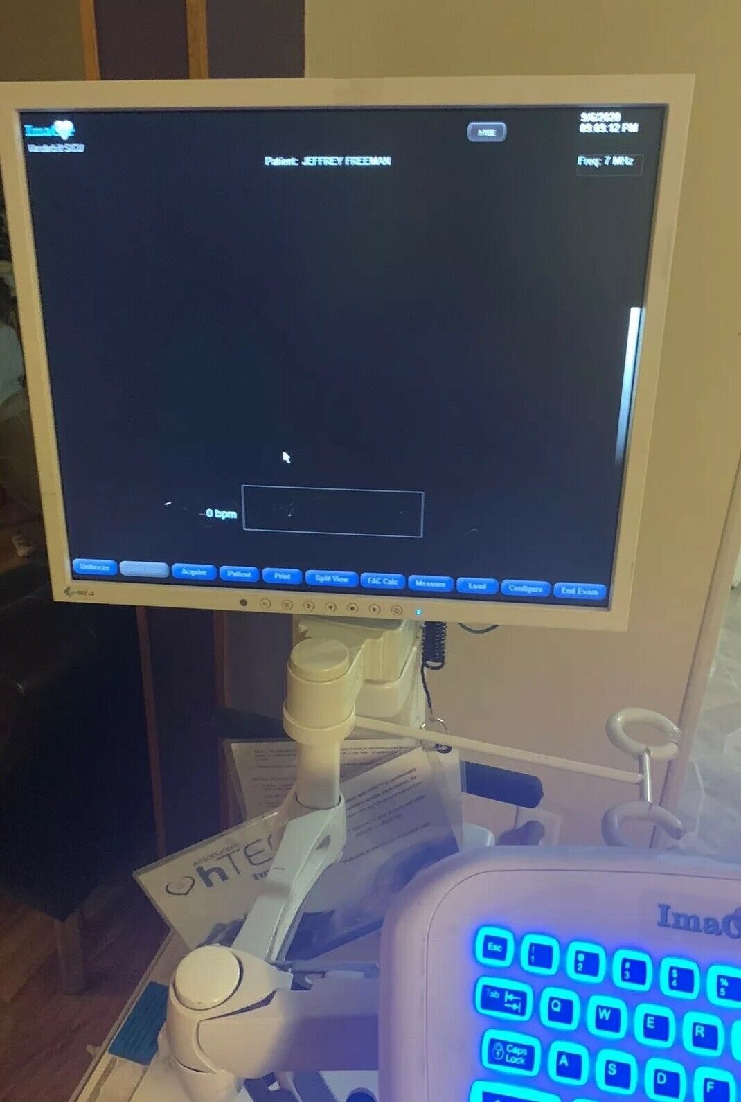 ImaCor Hemodynamic Ultrasound Machine Zura-1000 System DIAGNOSTIC ULTRASOUND MACHINES FOR SALE