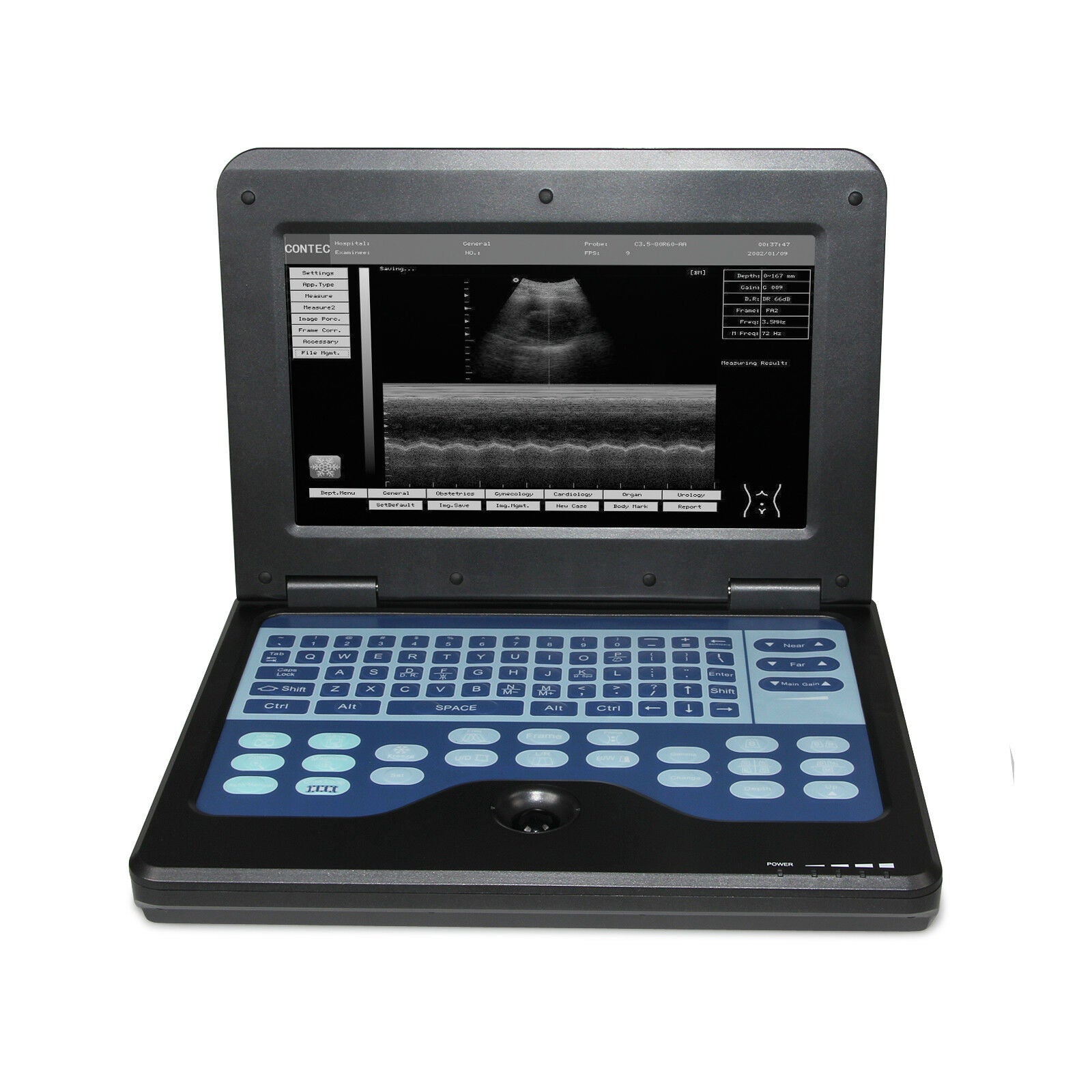 Portable Ultrasound Scanner Diagnostic Device Machine Convex / Linear 2 Probes DIAGNOSTIC ULTRASOUND MACHINES FOR SALE