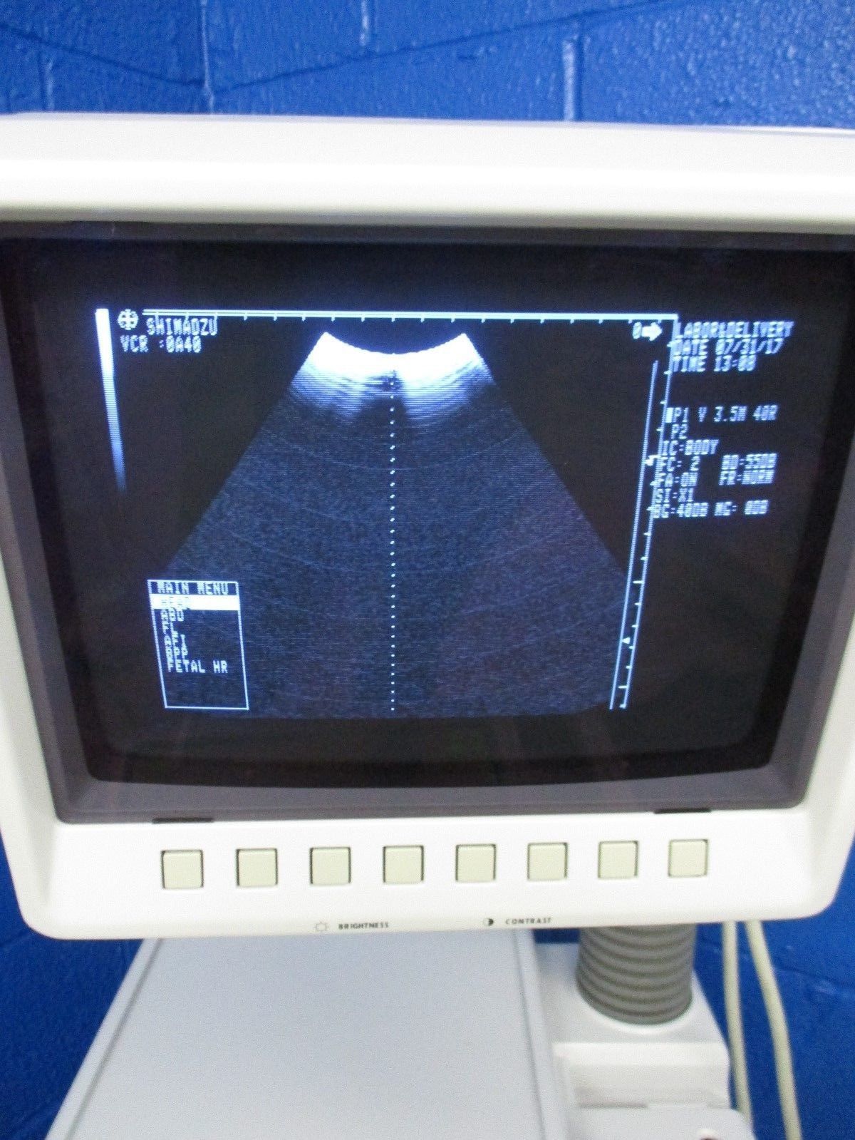 Shimadzu SDU-400 Plus A Ultrasound DIAGNOSTIC ULTRASOUND MACHINES FOR SALE