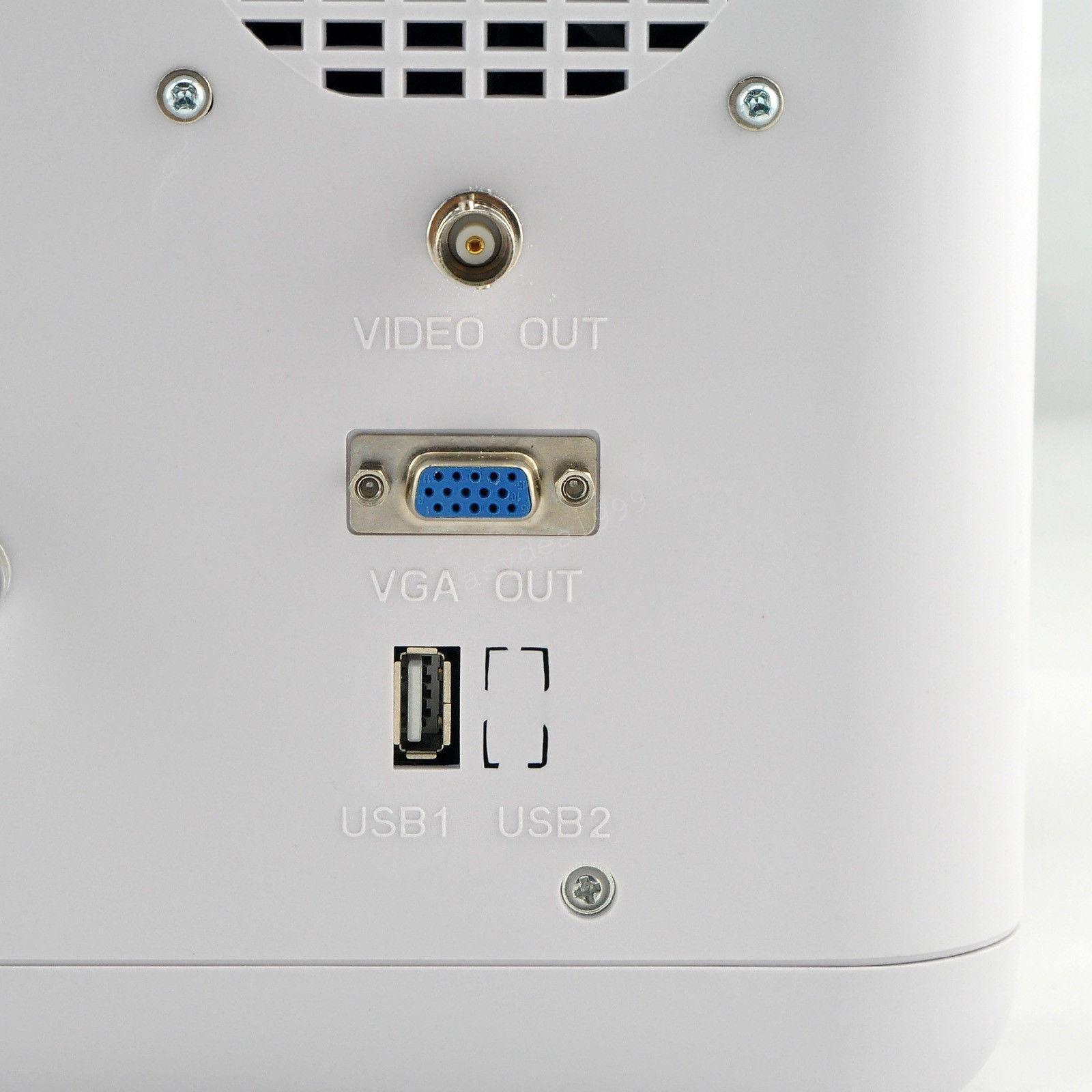 Digital Portable Ultrasound Scanner Machine Convex Linear Transvaginal 3 Probes* DIAGNOSTIC ULTRASOUND MACHINES FOR SALE