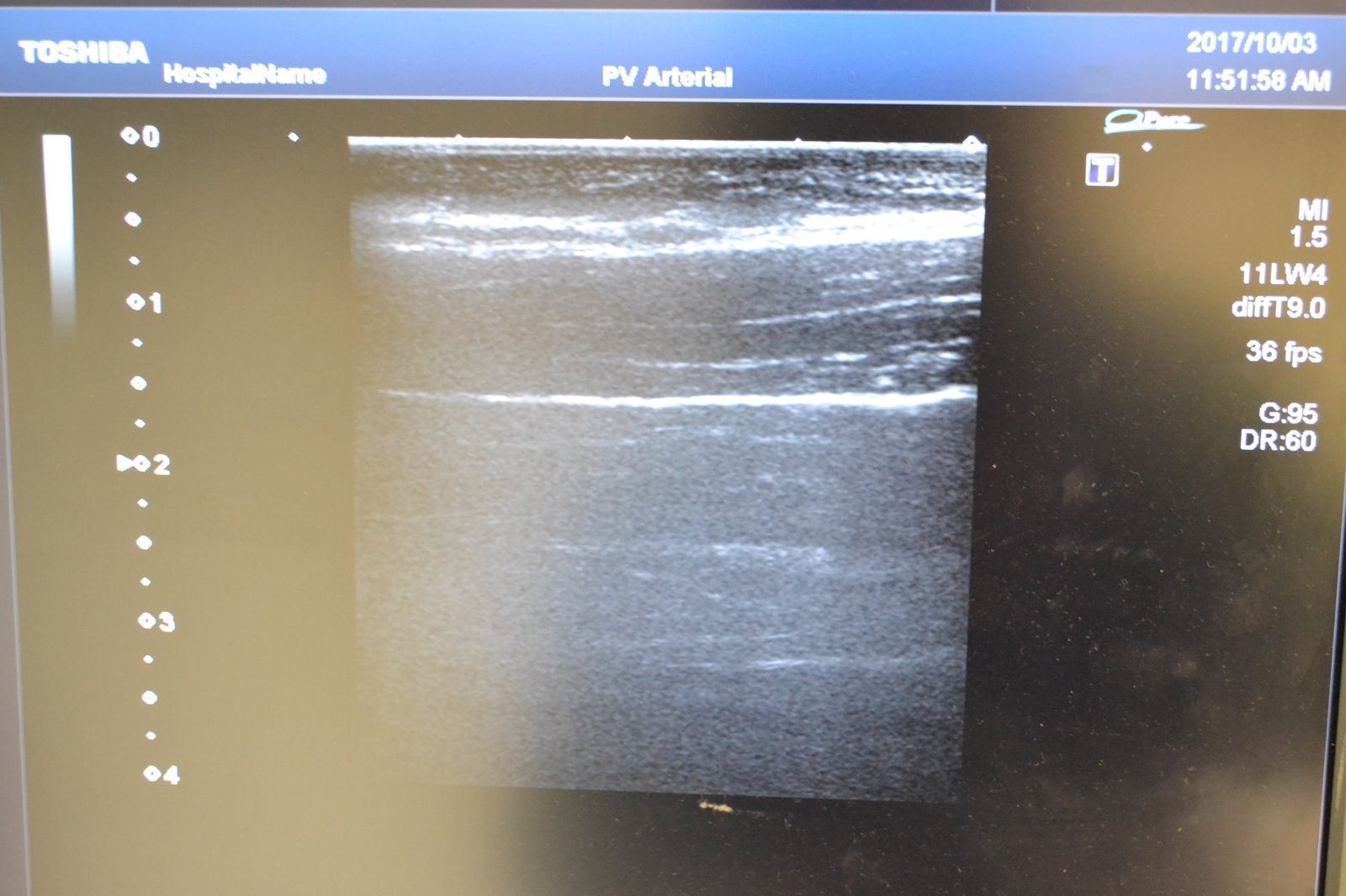Toshiba Artida PLT-704SBT 11-4.8MHz Linear Ultrasound Transducer Probe J1628 DIAGNOSTIC ULTRASOUND MACHINES FOR SALE
