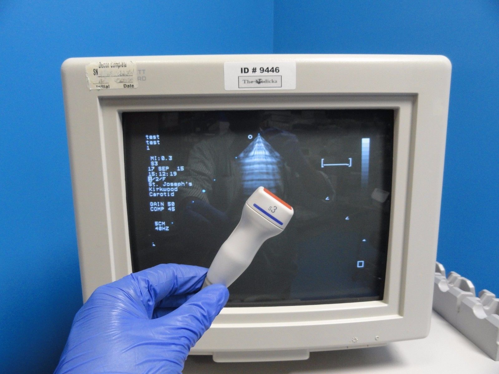 hand touching probe infront of monitor